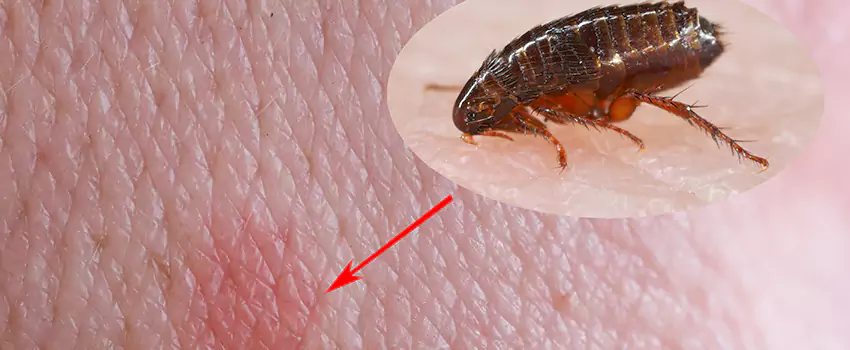 Flea Control for Humans Prosper, TX